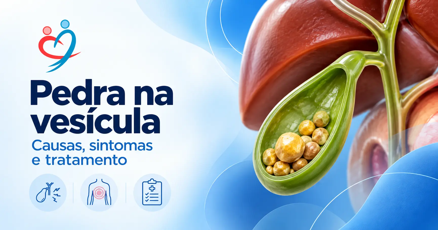 Pedra na vesícula: causas, sintomas e tratamento